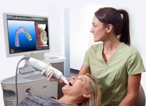 d iTero 3D digital scanner to create accurate dental impressions, enhancing orthodontic, Invisalign, and restorative treatment planning.