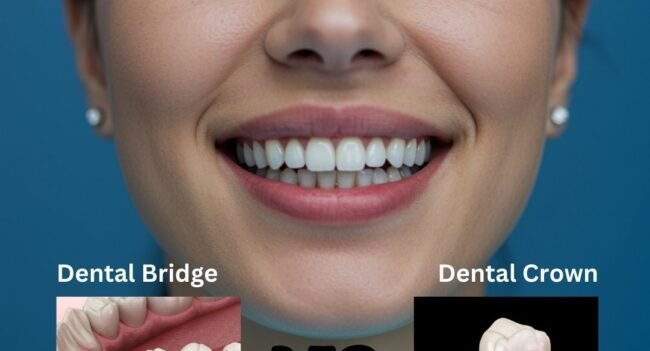 Dental bridge and dental crown treatment comparison for restoring damaged and missing teeth.
