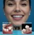 Dental bridge and dental crown treatment comparison for restoring damaged and missing teeth.