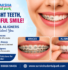 image showing before and after the braces treatment
