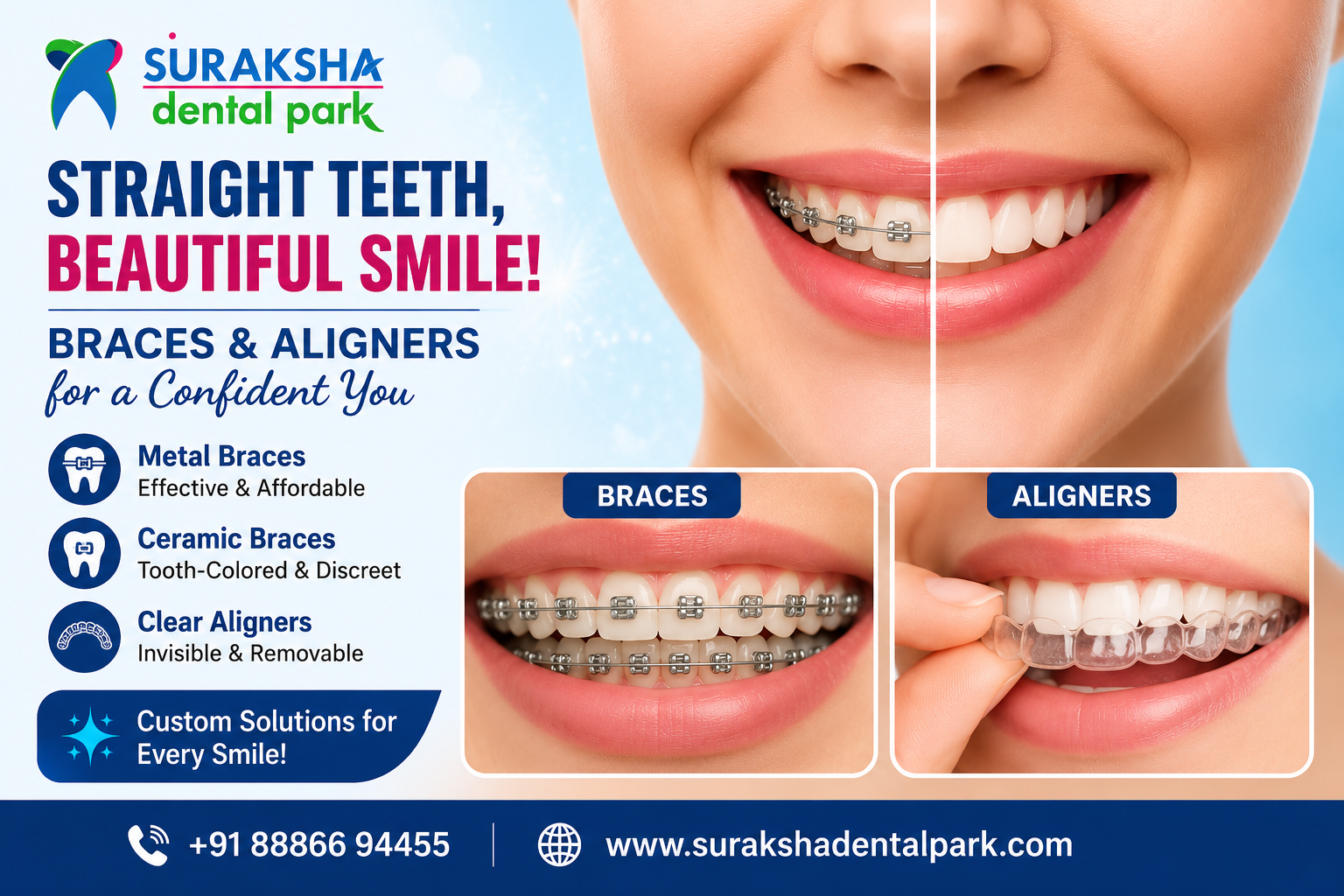 image showing before and after the braces treatment