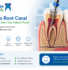Teeth getting done the root canal treatment